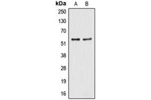 Western blot analysis of ALDH2 expression in HegG2 (A), A549 (B) whole cell lysates. (ALDH2 antibody  (N-Term))