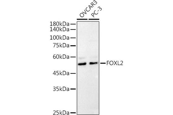 FOXL2 antibody  (C-Term)