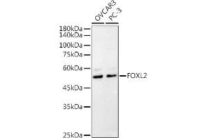 FOXL2 anticorps  (C-Term)