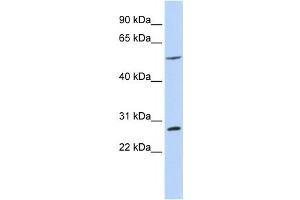 Western Blotting (WB) image for anti-BTB (POZ) Domain Containing 2 (BTBD2) antibody (ABIN2458093) (BTBD2 antibody)