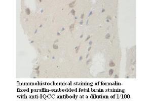Image no. 1 for anti-IQ Motif Containing C (IQCC) antibody (ABIN1577296) (IQCC antibody)
