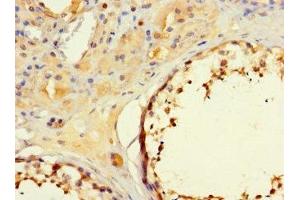 Immunohistochemistry of paraffin-embedded human testis tissue using ABIN7160194 at dilution of 1:100 (MORC1 antibody  (AA 683-984))