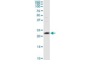 PRDX2 MaxPab polyclonal antibody. (Peroxiredoxin 2 antibody  (AA 1-198))