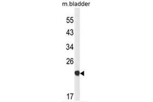 Western blot analysis of CLDN23 Antibody (C-term) in mouse bladder tissue lysates (35µg/lane). (Claudin 23 antibody  (C-Term))