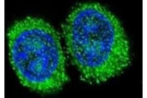 Confocal immunofluorescent analysis of NPC1 antibody with 293 cells followed by Alexa Fluor 488-conjugated goat anti-rabbit lgG (green). (NPC1 antibody  (AA 591-620))