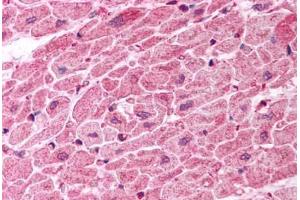 Human Heart (formalin-fixed, paraffin-embedded) stained with TICAM1 antibody ABIN457458 at 10 ug/ml followed by biotinylated goat anti-rabbit IgG secondary antibody ABIN481713, alkaline phosphatase-streptavidin and chromogen. (TICAM1 antibody  (C-Term))