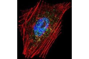 Immunofluorescence (IF) image for anti-Parkinson Protein 2, E3 Ubiquitin Protein Ligase (Parkin) (PARK2) antibody (ABIN3002635) (Parkin antibody)