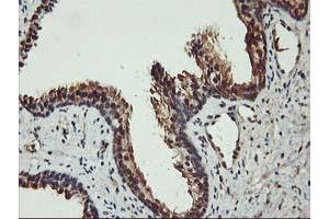 Image no. 8 for anti-V-Akt Murine Thymoma Viral Oncogene Homolog 1 (AKT1) antibody (ABIN1496554) (AKT1 antibody)