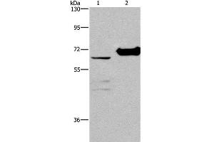 Western Blot analysis of 231 cell and Mouse kidney tissue using CHDH Polyclonal Antibody at dilution of 1:400 (CHDH antibody)