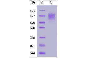 Biotinylated Human CD30, Avitag,His Tag on  under reducing (R) condition. (TNFRSF8 Protein (AA 19-379) (His tag,AVI tag,Biotin))