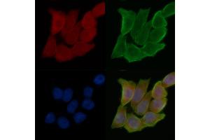 ABIN7095237 and ABIN7099294 staining Hela cells(45 min of heat-shock treatment) by IF/ICC. (TRIM72 antibody)