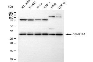 Western blotting analysis using CSNK1A1 antibody (ABIN7797880). (Recombinant CSNK1A1 antibody)