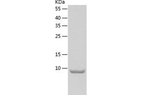 CXCL5 Protein (AA 49-118) (His tag)