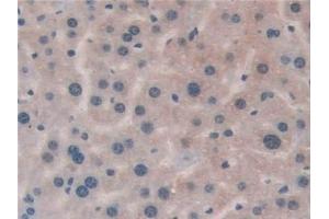 Detection of HLA-DRB1 in Mouse Liver Tissue using Polyclonal Antibody to HLA Class II Histocompatibility Antigen, DRB1 Beta Chain (HLA-DRB1)