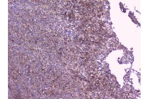IHC analysis of PBP using anti-PBP antibody (ABIN5693043).