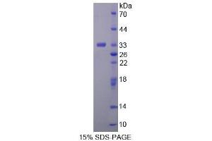 SDS-PAGE (SDS) image for Trehalase (Brush-Border Membrane Glycoprotein) (TREH) (AA 151-411) protein (His tag) (ABIN3209958) (TREH Protein (AA 151-411) (His tag))