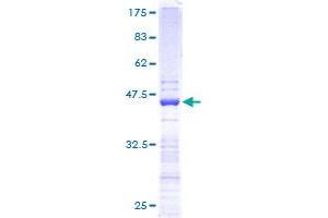 Image no. 1 for Ribosomal Protein S19 (RPS19) (AA 1-145) protein (GST tag) (ABIN1318760)