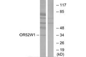 Western blot analysis of extracts from HeLa cells, using OR52W1 Antibody. (OR52W1 antibody  (AA 271-320))
