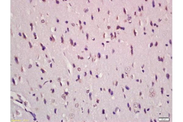 TGF-beta antibody  (AA 301-350)