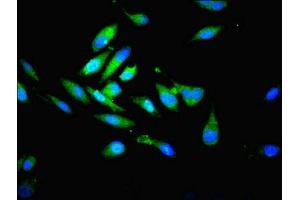 Immunofluorescent analysis of Hela cells using ABIN7164986 at dilution of 1:100 and Alexa Fluor 488-congugated AffiniPure Goat Anti-Rabbit IgG(H+L) (PSMB7 antibody  (AA 44-275))