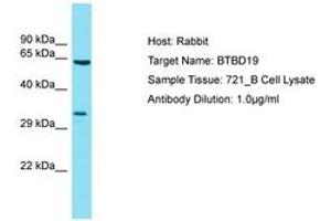 Image no. 1 for anti-BTB (POZ) Domain Containing 19 (BTBD19) (AA 208-257) antibody (ABIN6750766) (BTBD19 antibody  (AA 208-257))