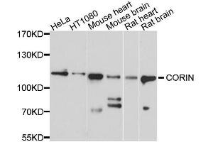 Western blot analysis of extracts of various cell lines, using CORIN antibody. (Corin antibody  (AA 1-110))