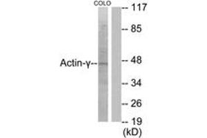 Western blot analysis of extracts from COLO205 cells, using Actin-gamma2 Antibody. (ACTG2 antibody  (AA 1-50))