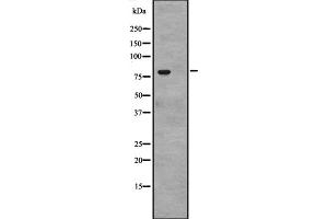 Western blot analysis of CACNB4 expression in Human Bone Marrow lysates in RIPA buffer,The lane on the left is treated with the antigen-specific peptide. (CACNB4 antibody  (C-Term))