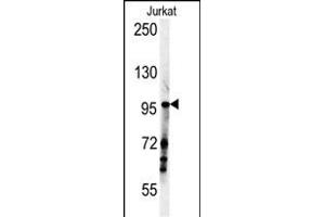 SG1 Antibody (N-term) (ABIN651886 and ABIN2840439) western blot analysis in Jurkat cell line lysates (35 μg/lane). (SPAG1 antibody  (N-Term))