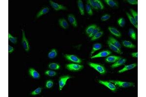 Immunofluorescent analysis of Hela cells using ABIN7160982 at dilution of 1:100 and Alexa Fluor 488-congugated AffiniPure Goat Anti-Rabbit IgG(H+L) (CYB5R3 antibody  (AA 1-301))