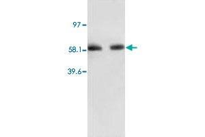Western Blot analysis of RELA expression from human colon carcinoma lyate with RELA polyclonal antibody .