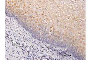 Immunoperoxidase of monoclonal antibody to PIM1 on formalin-fixed paraffin-embedded human esophagus. (PIM1 antibody  (AA 1-313))