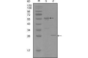 Western blot analysis using PGR mouse mAb against truncated MBP-PGR recombinant protein (1) and truncated Trx-PGR(aa730-871) recombinant protein (2). (Progesterone Receptor antibody  (AA 730-871))