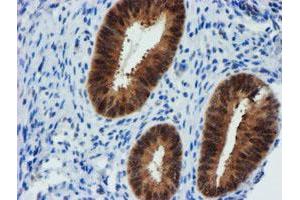 Image no. 9 for anti-F-Box Protein 21 (FBXO21) antibody (ABIN1498235)