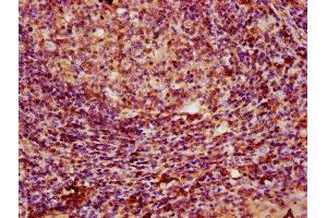 IHC image of ABIN7163751 diluted at 1:100 and staining in paraffin-embedded human tonsil tissue performed on a Leica BondTM system. (PARP3 antibody  (AA 1-240))