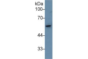 Western Blot; Sample: Rat Small intestine lysate; Primary Ab: 1µg/ml Rabbit Anti-Rat KRT8 Antibody Second Ab: 0. (CAP1 antibody  (AA 38-149))