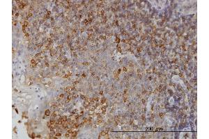 Immunoperoxidase of monoclonal antibody to NMI on formalin-fixed paraffin-embedded human tonsil. (NMI antibody  (AA 1-100))