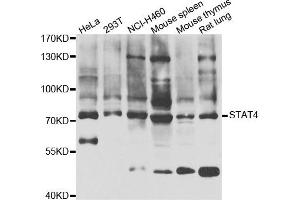 Western blot analysis of extracts of various cell lines, using STAT4 antibody. (STAT4 antibody)