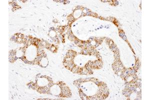 Immunohistochemistry (IHC) image for anti-Dihydrolipoamide S-Succinyltransferase (E2 Component of 2-Oxo-Glutarate Complex) (DLST) (AA 50-100) antibody (ABIN7455019) (DLST antibody  (AA 50-100))