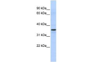 WB Suggested Anti-TADA2L Antibody Titration:  0. (TADA2L antibody  (N-Term))