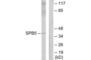 Western Blotting (WB) image for anti-serpin Peptidase Inhibitor, Clade B (Ovalbumin), Member 5 (SERPINB5) (Internal Region) antibody (ABIN1850504) (SERPINB5 antibody  (Internal Region))