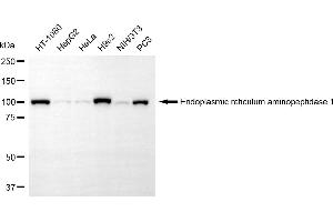 Western blotting analysis using endoplasmic reticulum aminopeptidase 1 antibody (ABIN7798442).