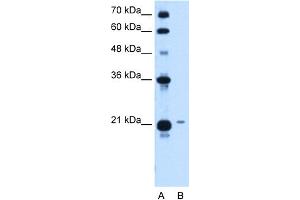 WB Suggested Anti-TCP10L Antibody Titration:  1. (TCP10L antibody  (Middle Region))
