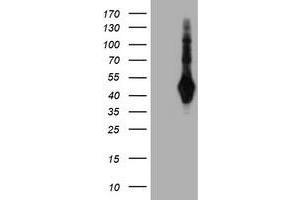 HEK293T cells were transfected with the pCMV6-ENTRY control (Left lane) or pCMV6-ENTRY SH2D2A (Right lane) cDNA for 48 hrs and lysed. (SH2D2A antibody)