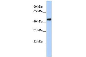 QTRTD1 antibody used at 1 ug/ml to detect target protein.