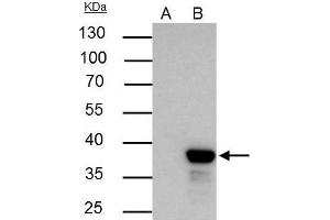 Immunoprecipitation (IP) image for anti-Nonhomologous End-Joining Factor 1 (NHEJ1) antibody (ABIN2857060)