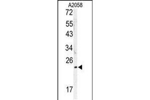Western blot analysis of MOBKL1B antibody in A2058 cell line lysates (35ug/lane) (MOB1A antibody  (C-Term))