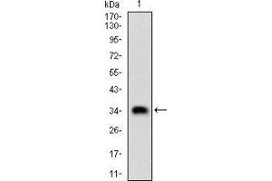 Fig. (CSNK2B antibody  (AA 1-215))