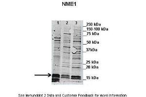 Lanes:   1. (NME1 antibody  (N-Term))