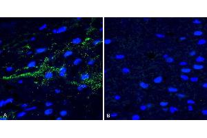 Immunohistochemistry analysis using Rabbit Anti-Alpha Synuclein (pSer129) Polyclonal Antibody (ABIN5650948). (SNCA antibody  (pSer129) (FITC))
